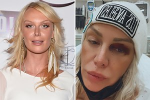 CariDee rushed to hospital after suffering ‘serious head injury’