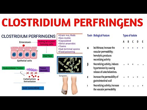Clostridium perfringens || Gas gangrene || Medical Microbiology