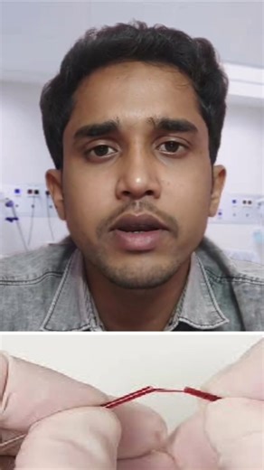 Clotting time|| BT,CT || Clotting time q karte h #trending #shorts #viral #study #medical