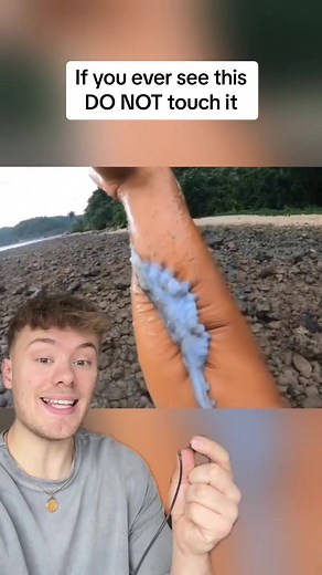 Don't Touch! Detached Octopus Limb Can Live & Stick