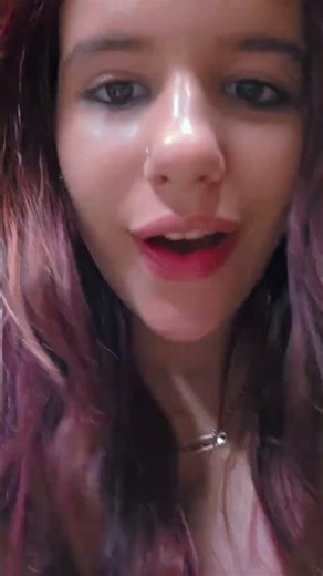 Ankle + foot sprain. Idk how to walk ig