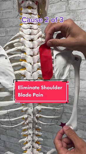 Do you experience shoulder blade, pain, pain along the spine or below the neck? Have you spent a ton of time digging into it and trying to stretch that muscle? Well that hasn’t worked. There are three main sources of pain. We must look at the rib heads, where they attached to the spine, referred pain from the discs in the neck or muscle spasms in the rhomboid muscle. In this video, I demonstrate how to address all three of them. See which one works for you through a process of elimination to ide