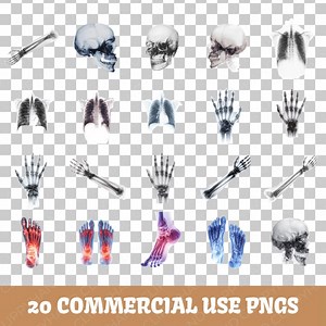 20 Xray Clipart, Medical Art, Skeleton Graphics, Anatomy Art, Science Clipart, Transparent Png, Bone Structure, Commercial Use - Etsy