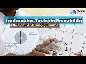Comment Analyser un Antibiogramme : Tutoriel de Lecture des Tests de Sensibilité