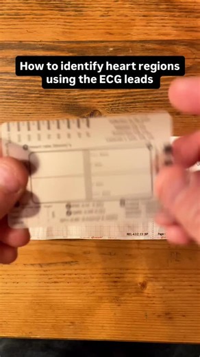 14K views · 1.1K reactions | Understanding What Each ECG Lead Tells...