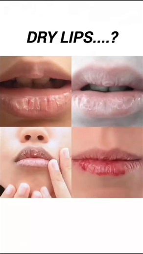 Homemade remedy for dry lips 👄 #drylips #soft #lipcare #shorts #pinklipsathome #beautytips