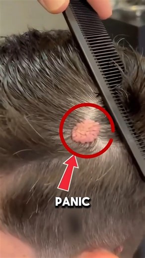 Is that really his brain?🤯