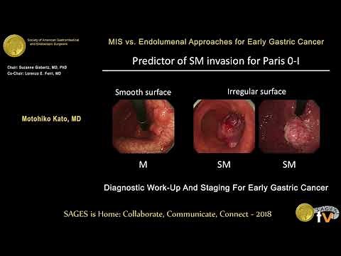 Diagnostic work-up & staging for early gastric cancer
