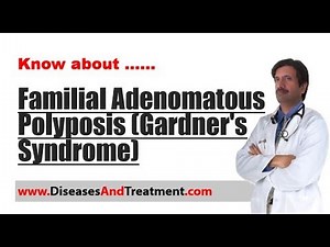 Familial Adenomatous Polyposis (Gardner's Syndrome) : Causes, Diagnosis, Symptoms, Treatment