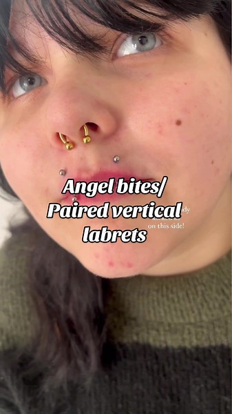 Angel Bites and Paired Vertical Labrets Downsize Update