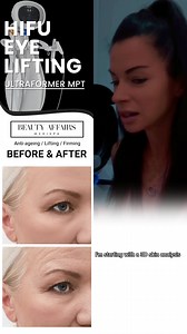 6.2K views | ✨ Real Results, Limited-Time Offer! ✨ ⭐️⭐️⭐️⭐️⭐️ “The...