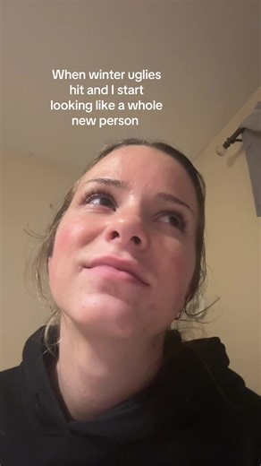 Navigating Winter's Impact on Your Look