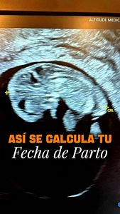 🤰📅 ¿Quieres saber cuántas semanas de embarazo tienes o tu fecha probable de parto? 💡 En el primer ultrasonido, medimos el tamaño del embrión y con eso calculamos con precisión tus semanas y el día más aproximado en que conocerás a tu bebé 👶💓. #embarazo #embarazada #ultrasonido #pregnancy #momtobe | Dr Carlos Uribe Monarrez