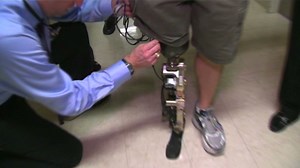 Bionic leg propels man up 103 flights