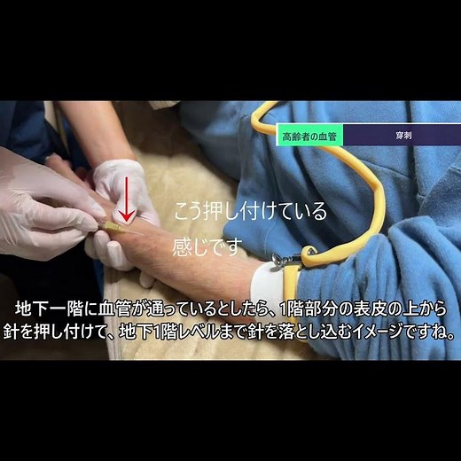 Professional #IV drip #IV access #Peripheral venous access #Resident #Nurse 3