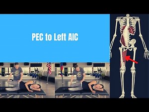 Hamstring, Adductor, Internal Obliques, and Diaphragm: Why the Right Side Restores First in a PEC