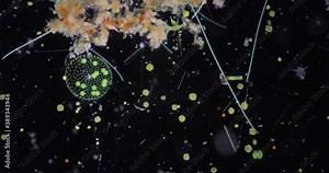 Volvox in drop of water under the microscope for classroom education.