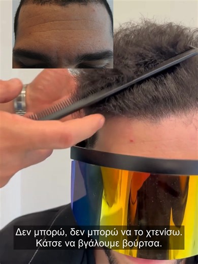 12 μήνες μετά από 2500 τριχοθυλάκια FUE, ο Παναγιώτης απολαμβάνει πυκνότητα μπροστά και στην κορυφή, με φυσικό αποτέλεσμα ακόμα και με λεπτή τρίχα 💇‍♂️✨ Βρεγμένο, στεγνό, χωρίς φίλτρα — η διαφορά φαίνεται. Το έχει πει σε όλους ότι έκανε μεταμόσχευση. Κανείς δεν το πιστεύει. 💯 Αυτό σημαίνει σωστός σχεδιασμός και πραγματική τεχνική. 💪🔥 #hairtransplant #FUE #metamosxefsimalion #hairline #beforeafter