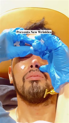 Botox injections in the forehead are a common cosmetic procedure used...