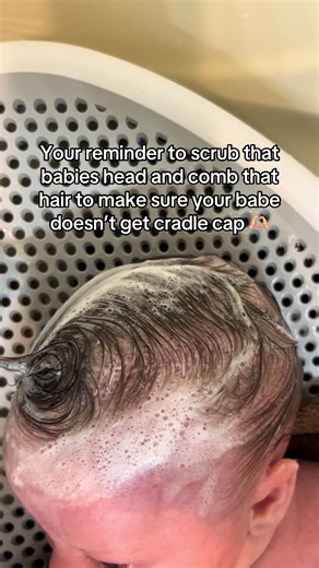 It’s so easy to forget this step but it’s SO important even if your baby doesn’t have any hair!! Protect their skin from cradle cap by scrubbing and combing, thank me later 🥰 #babiesoftiktok #hair #momsoftiktok #fridamom #cradlecap