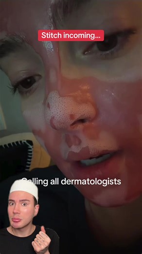 Effective Methods to Eliminate Blackheads