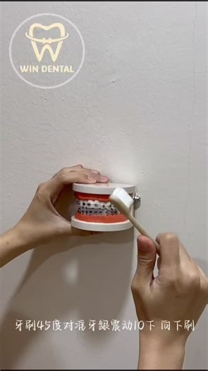 Win Dental Clinic on Instagram: "The modified Bass technique is a highly effective, dentist-recommended brushing method that removes plaque at and below the gumline. It involves : 1. Angle the Brush: Place the soft toothbrush bristles at a 45-degree angle to the gum line (sulcus). 2.Vibratory Motion: Apply light pressure and use small, gentle, back-and-forth or vibratory circular motions for about 10–20 seconds per area. 3.Sweep Away: After vibrating, sweep the bristles away from the gumline (do