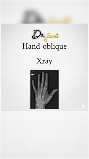 ‎د.عادل جاولي‎ on Instagram‎: "Hand oblique view د.عادل جاولي اخصائي تصوير طبي"‎