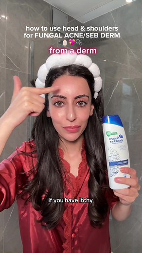 How to Use Head & Shoulders as a Facewash to Treat Fungal Acne & Seb Derm