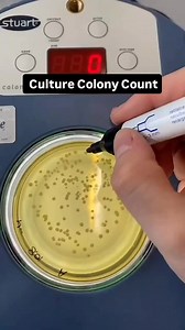 Culture colony count #microbiology #biology #science #reelsviralシ #reelvideo2024 #viralreel2025 #fbreelsfypシ゚ #viralvideoシ #viralreelsfacebook #reelstrending #viralreelschallenge #bdreels | Microbiologist BD
