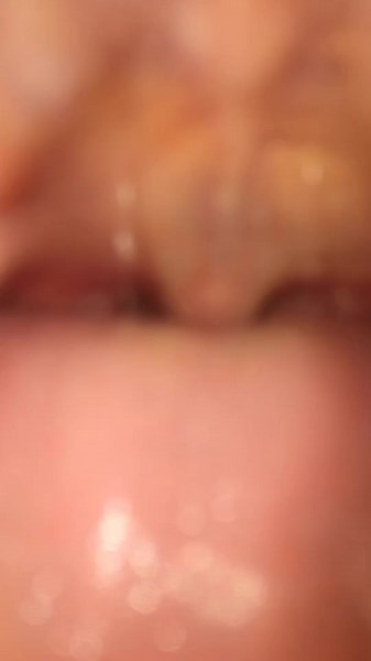 !! #mouth #inside #fyp #foryou #viral #foryoupage #okay #notforyou #notfyp #nfyp