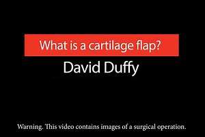 What Does Damaged Knee Cartilage Look Like?