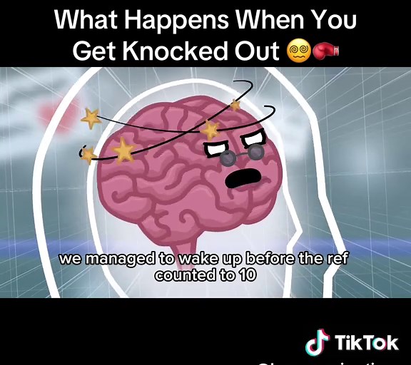 Getting knocked out isn’t just “falling asleep.” Your brain literally shuts down to protect itself. 🧠⚡ Vision blurs, balance disappears, and your body hits emergency mode. Ever seen someone get KO’d in real life? 👀🥊 Follow @human_animationn for more content🚀 #Knockout #BrainReaction #HumanBody #FightScience #BodyShutdown This is the original one from youtube.