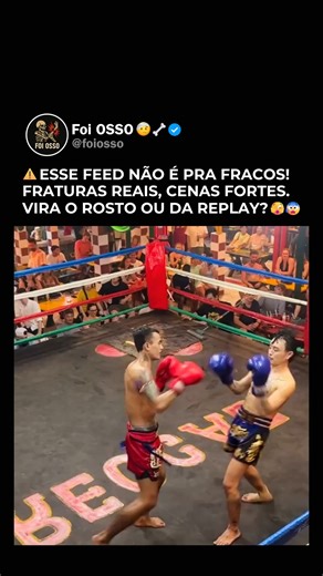 Foi OSSO 🤕🦴 on Instagram: "CLIQUE EM SEGUIR 👆 👆 👆 🦴 Sabia que? Ossos quebrados demoram de 6 a 12 semanas para cicatrizar O tempo de cicatrização depende do tipo de fratura, da idade e da saúde geral da pessoa. Crianças geralmente se recuperam mais rápido que adultos. Durante esse período, o osso passa por três fases: inflamação, formação de calo ósseo e remodelação. É importante seguir orientações médicas, evitar esforço excessivo e ter alimentação rica em cálcio e vitamina D para ajudar n