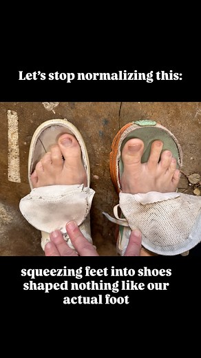 Your foot is not a triangle. So why are we forcing it into one? Tapered shoes deform your toes, weaken your base, and reduce balance. Fashion shouldn’t come at the cost of function. Comment FOOT FIX if you would like to get started in reversing the affect shoes have had on your feet ! #StabilityHack #BalanceTraining #HealthProfessionals #thestabilisationacademy #footrehab #anklerehab #footinjury #ankleinjury #footexercises #footstrength #ankleexercises #anklestrength #footbalance #gait #gaitanal