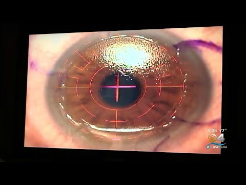 The Eye-Popping Reports Linked To LASIK Complications