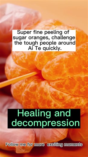 2023.6.20,Decompression, OCD patients, healing department.decompression video