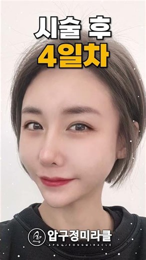 울퉁불퉁 무너진 윤곽선, 실리프팅으로 매끄럽게 정리