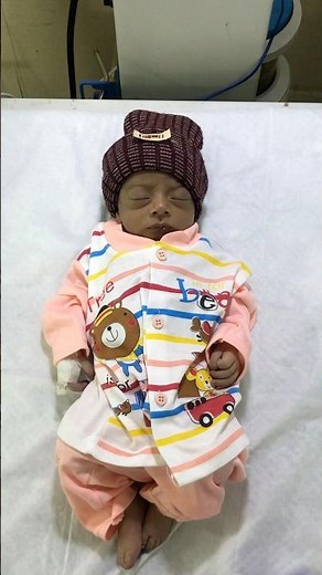 Blood Exchange Baby in NICU 👶🩸 | Exchange Transfusion Journey