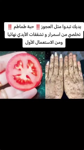 تخلصي من اسمرار و تشققات الأيدي مع حبة طماطم