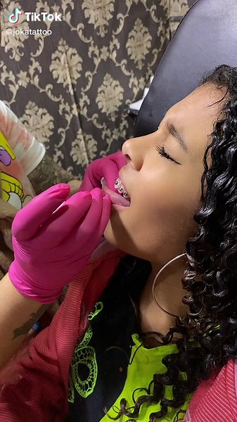 Braces Adjustment Procedure Explained