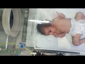 NG Tube Insertion for Newborn | Step-by-Step Nasogastric Tube Passing in NICU (Educational Video)