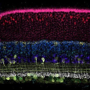 SABER tech gives DNA and RNA visualization a boost