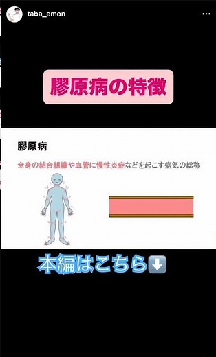 Characteristics of collagen disease #Pass #NationalExam #NursingStudent