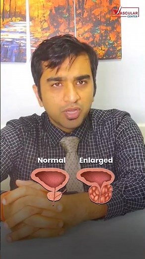 (BPH) Benign Prostate Hyperplasia क्या होता है? | Enlarged Prostate