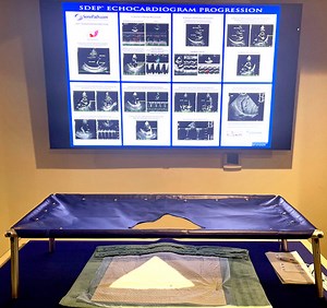 The NEW Cardi-Go!™ Cardiac Table | SonoPath