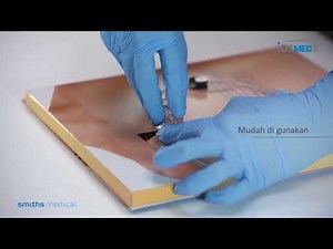 Smiths Medical | Gripper Micro