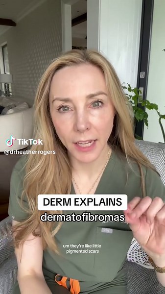 Dermatofibroma: Understanding and Caring for Your Skin