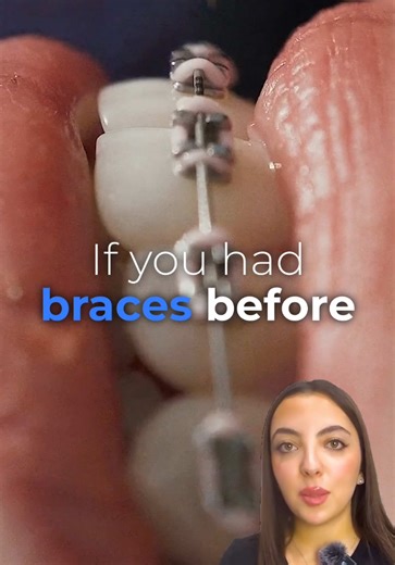 Straighten Your Teeth Without Metal Braces: Options Explained