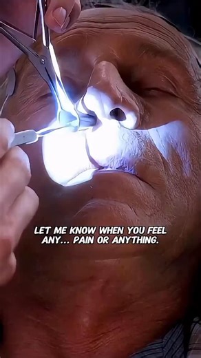 The Modern Medics on Instagram: "The anterior ethmoid neurovascular complex refers to the group of nerves and blood vessels—primarily the anterior ethmoidal artery, vein, and nerve—that pass through the anterior ethmoidal canal from the orbit into the nasal cavity. This complex supplies the anterior ethmoid sinus, frontal recess, and anterior part of the nasal septum and lateral wall. Its location is clinically important because injury during endoscopic sinus surgery can cause bleeding or cerebr