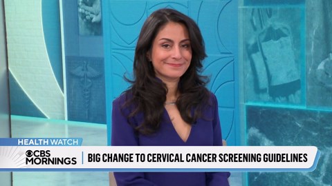 New cervical cancer screening guidelines suggest women can participate in collecting sample